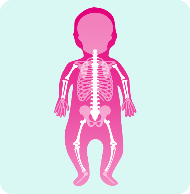 achondroplasia body image